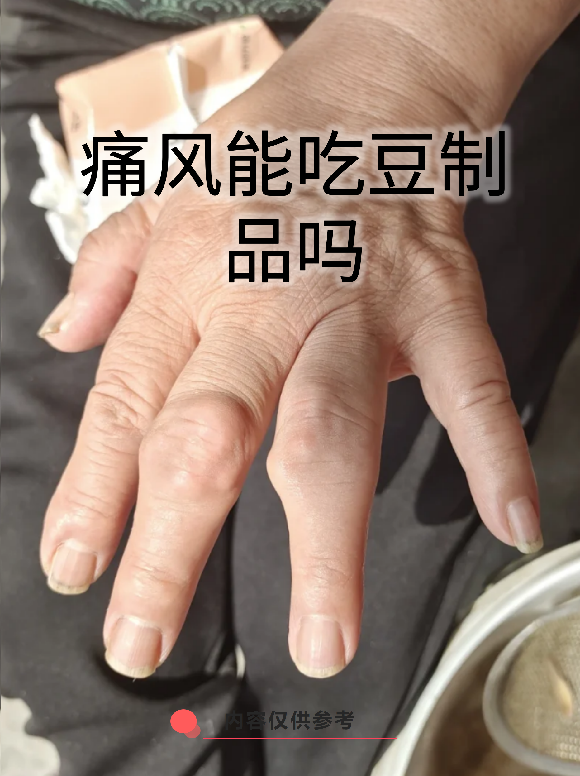 痛风患者可以啥凉菜(痛风凉拌菜) 痛风患者可以啥凉菜(痛风凉拌菜)